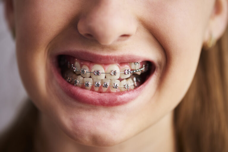 ortodoncias-funcionan-primera-1