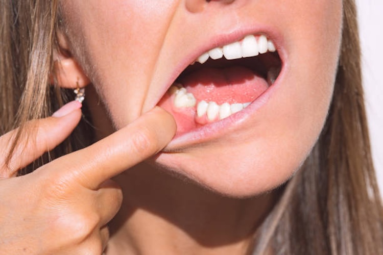 Young woman showing her mouth without tooth on lower jaw. Missing tooth, no tooth. Waiting an implant after tooth extraction. High quality photo