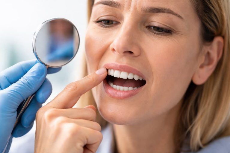 dientes-se-mueven-adultos-dentista-madrid